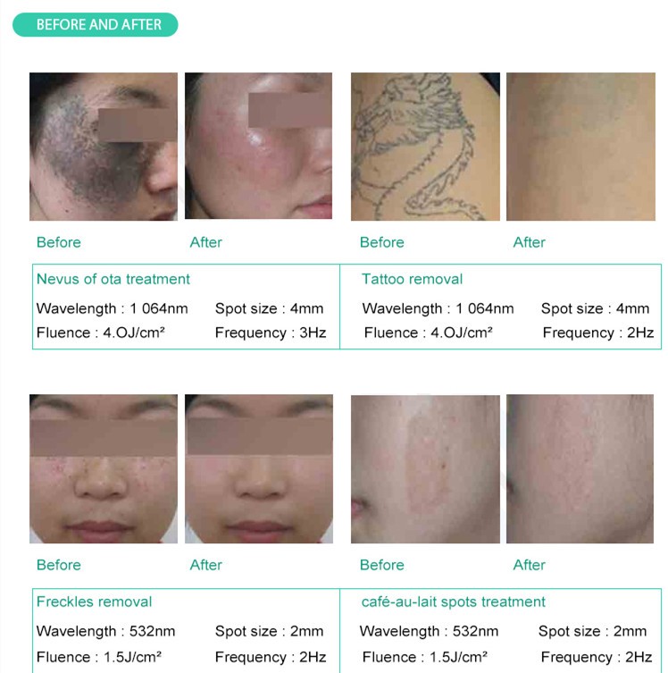 202107302033014999927