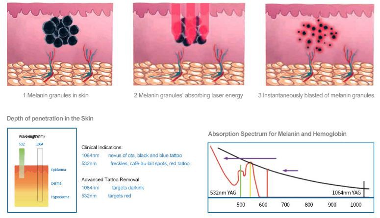 ~QT_MHA``6FV_G{8YA$T1P0 ~QT_MHA``6FV_G{8YA$T1P0