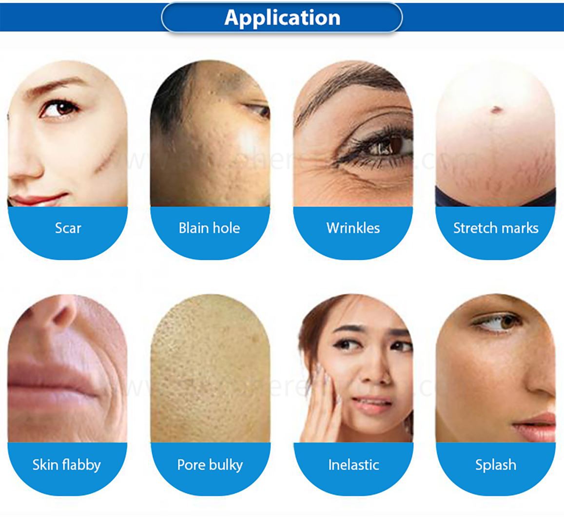 3-in-1-microneeding-(5)