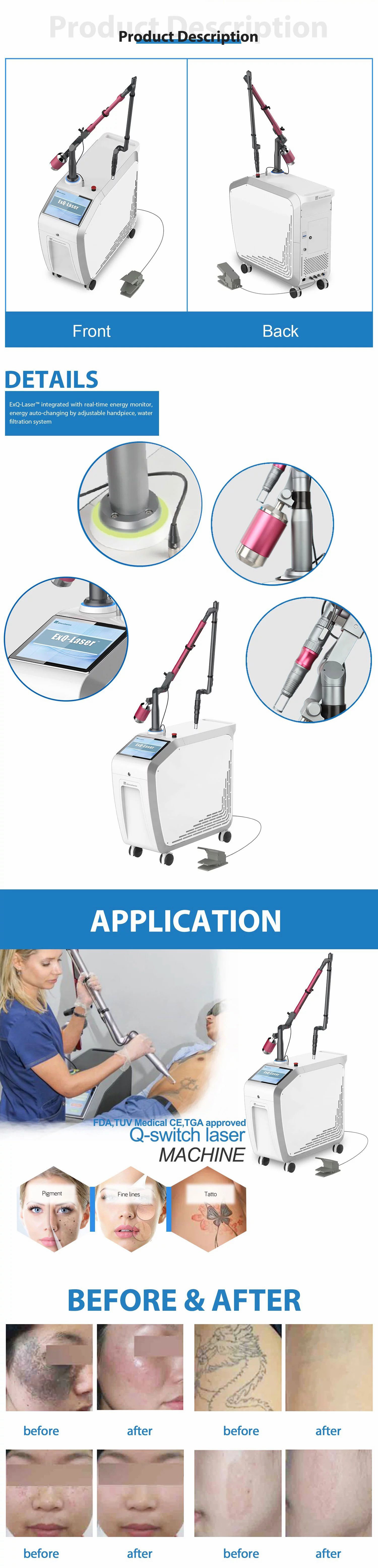 Q Switch ND YAG remove tattoos