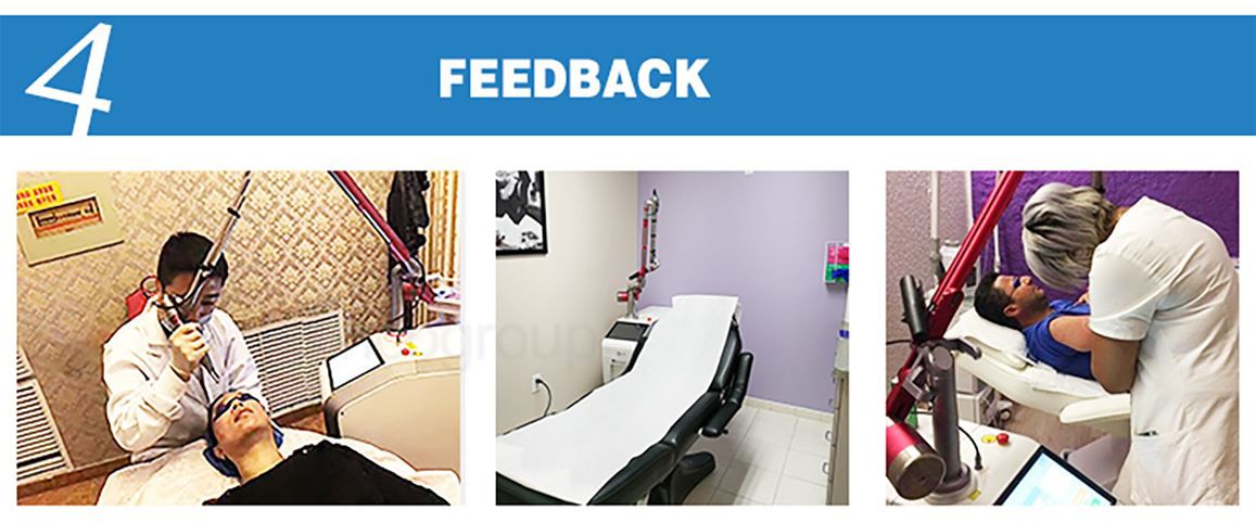 q switched ND yag laser q switched ND yag laser