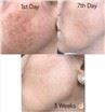 /uploads/202134052/small/2022-hot-ipl-diode-laser-hair-removal-755nm06497143578.jpg