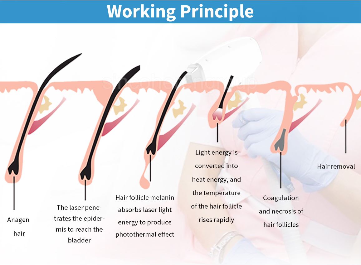 3 wavelength diode laser machine