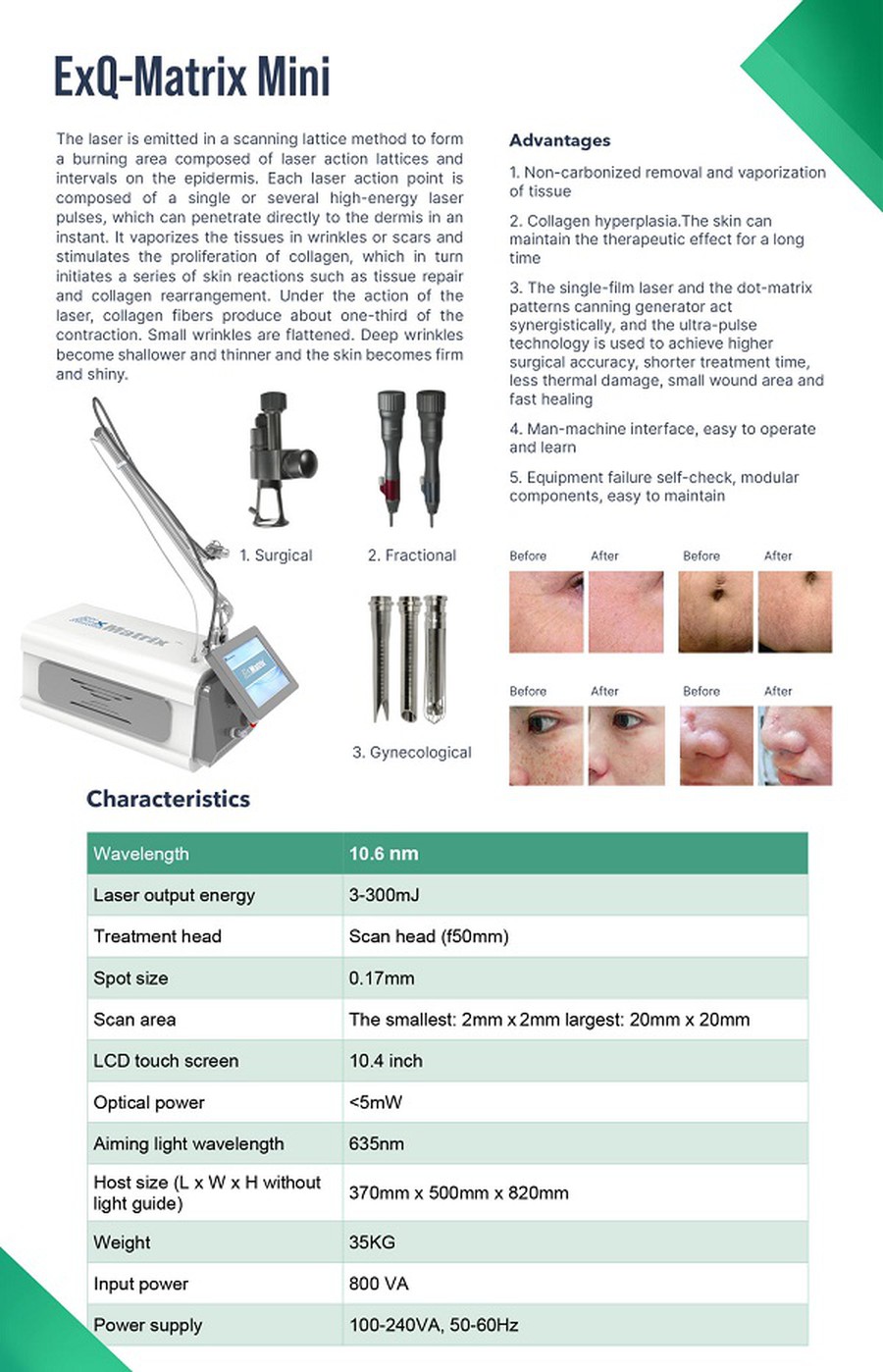 portable co2 beauty machine