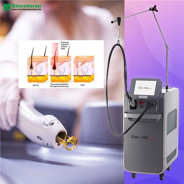 Alex Laser Machine For Hair Removal Machine