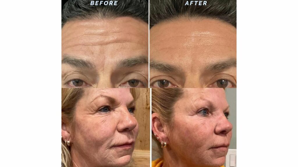 before&after before&after