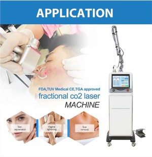 Co2 Skin Resurfacing Fractional Laser