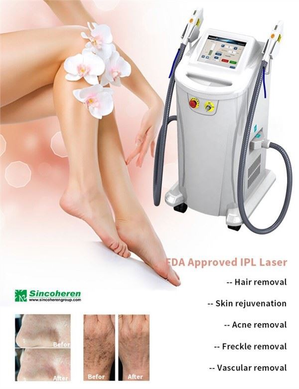 Hair Removal Skin Regeneration Manufacturer Med Spa Beauty Salon Ance