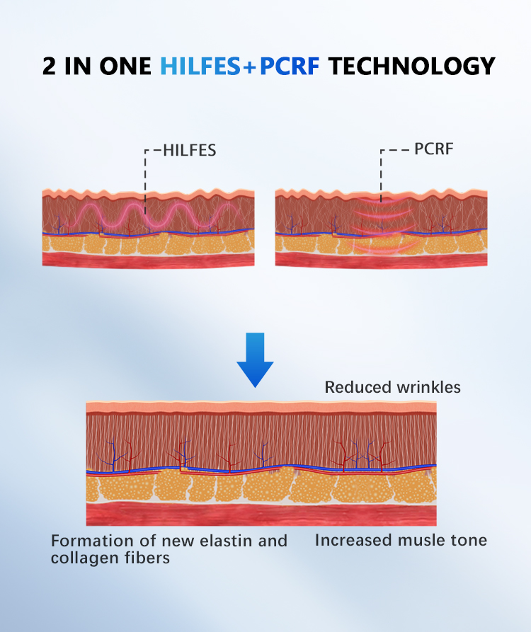 How it works How it works
