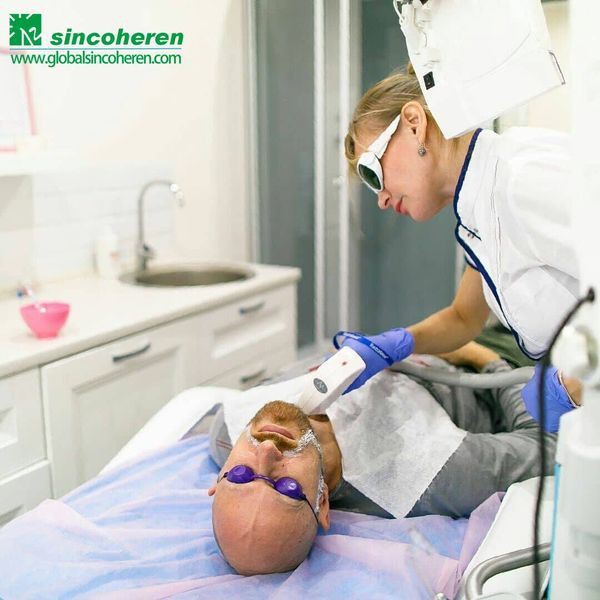 Laser hair removal tips