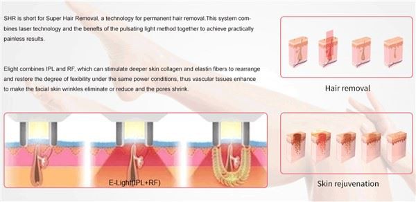 Multifunction Machine Ipl Laser Hair Removal Machine