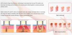 Multifunction Machine Ipl Laser Hair Removal Machine