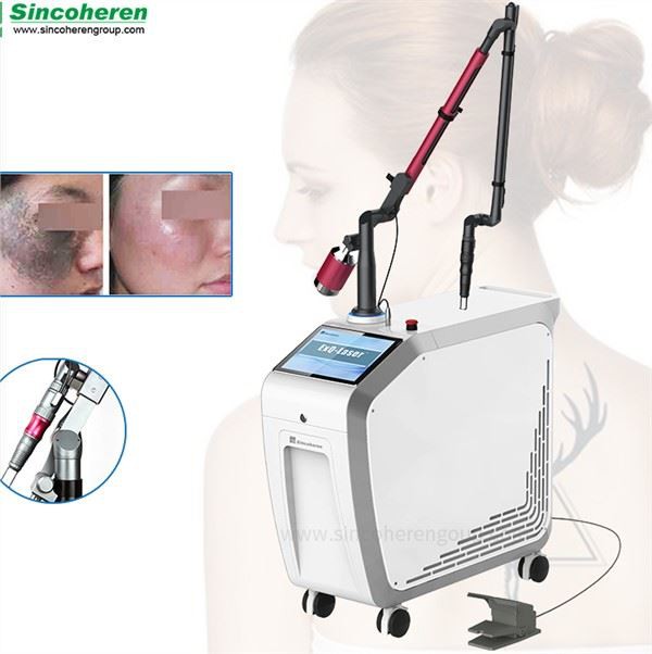 ND Yag Laser Tattoo Removal