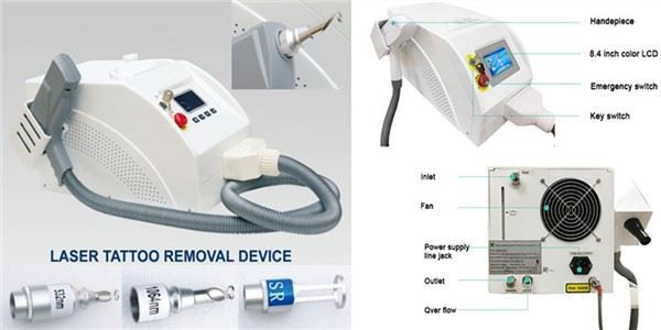 pigment-removal NDYag Laser