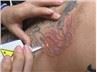 /uploads/202134052/small/portable-nd-yag-laser-tattoo-removal56246493463.jpg