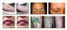 /uploads/202134052/small/portable-nd-yag-laser-tattoo-removal56278545717.jpg