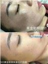 /uploads/202234052/small/portalbe-microneedling-rf-face-lifing-machine28224996826.jpg