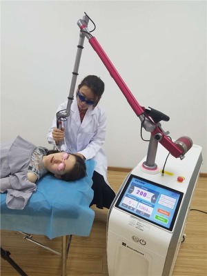 Q-switch Nd Yag Laser Picosecond Tattoo Acne Removal
