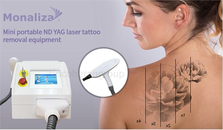 Sincoheren Mini Nd Yag Laser Tattoo Removal Machine