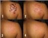 /uploads/202134052/small/sincoheren-mini-portable-nd-yag-laser-tattoo20267235956.jpg