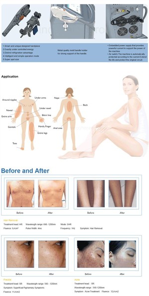 beauty salon used hair removal ipl