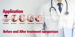 Unwanted Tissue Vaporization