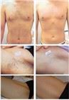 /uploads/202234052/small/verticle-ipl-nyc-3-cold-gentle-hair-removal35516744071.jpg