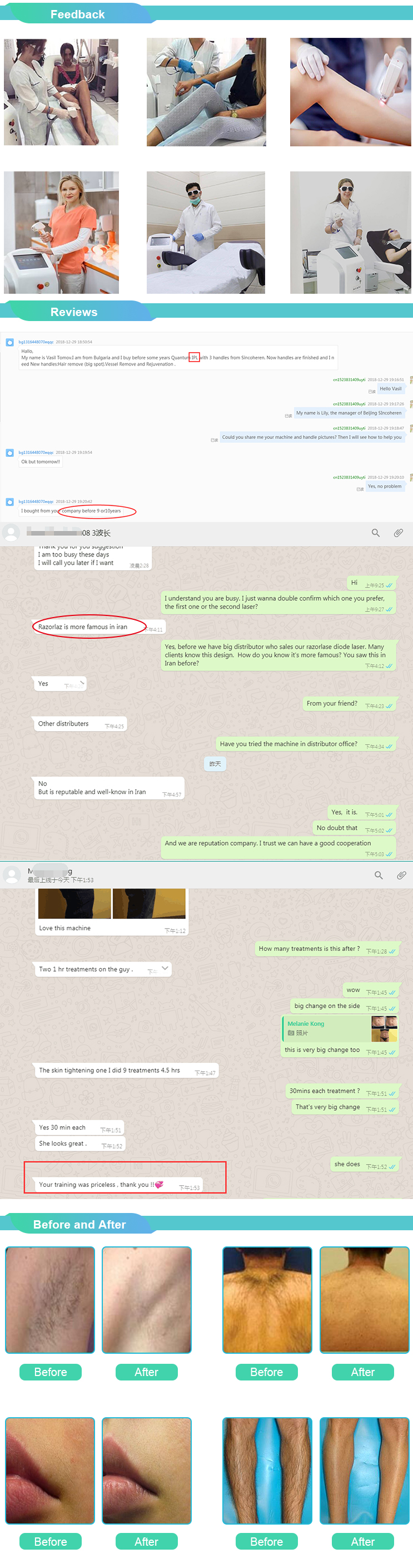 Medical CE/ISO13485 approved Intense pulsed light Sienna IPL  with shr two handles for hair removal and skin rejuvenation