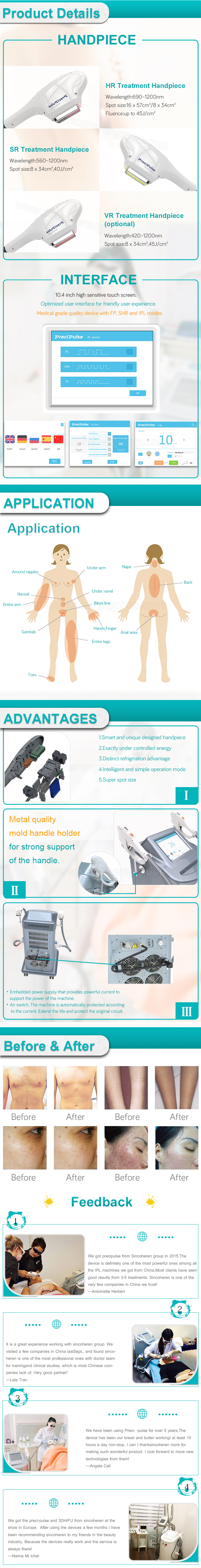 IPL hair removal (2)