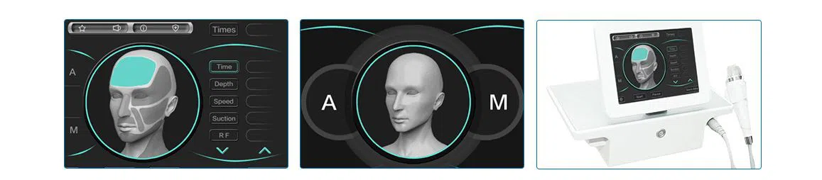 Microneedle.4 Microneedle.4
