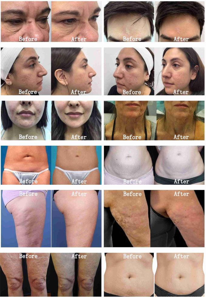 before&after before&after