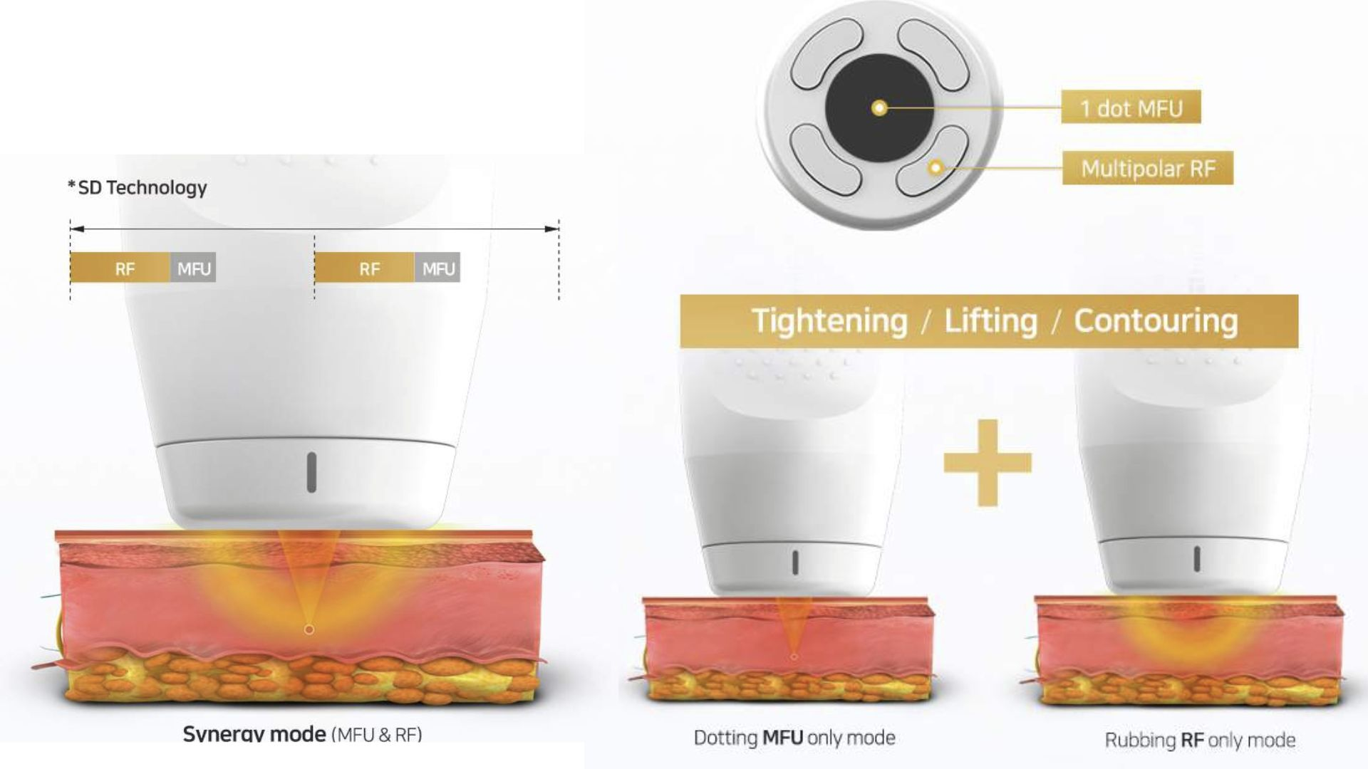 SD Technology SD Technology