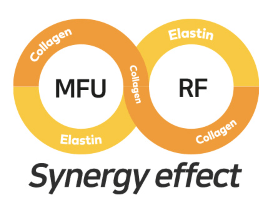 Synergy Effect Synergy Effect