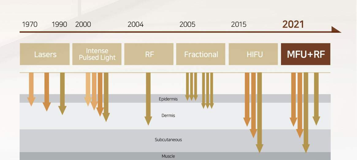 Ultralift SD Compact working principle Ultralift SD Compact working principle
