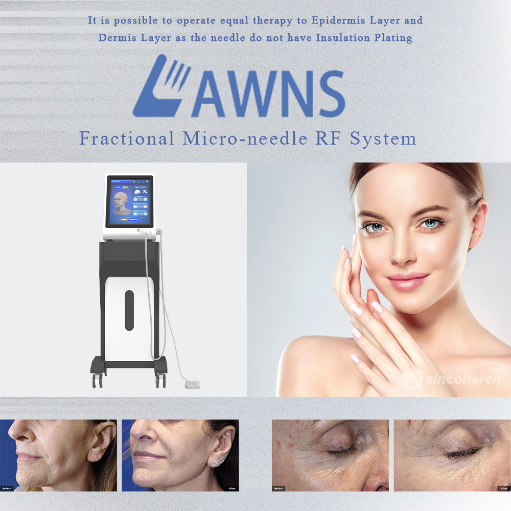 2024 Newest Microneedle Fractional RF Machine